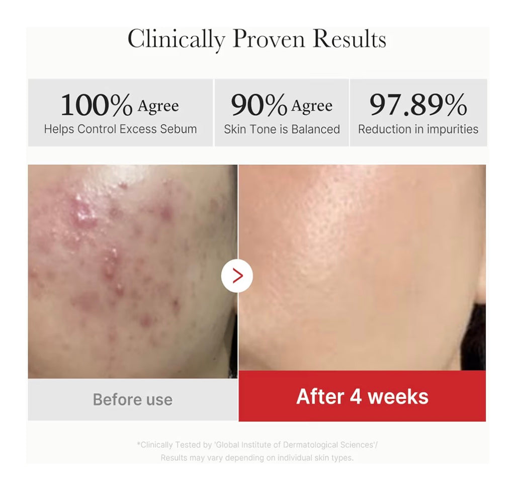 medicube Red Succinic Acid Panthenol Facial Peeling Pads - Exfoliating Toner Pads for Breakout-Prone Skin with Niacinamide, AHA, BHA, and Soothing Panthenol - Non-Comedogenic